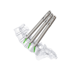 5.5 Minimally Invasive Pedical Screw
