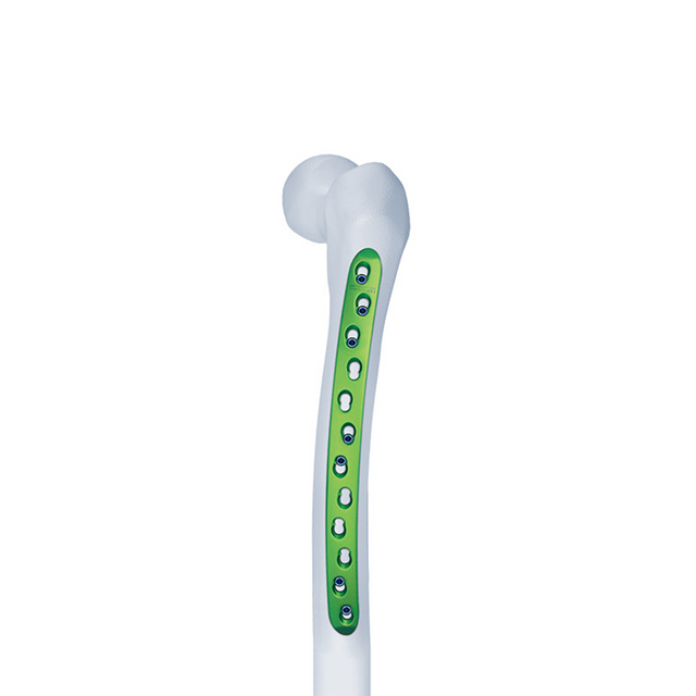 Curvam femur densis compressio laminam (lata)
