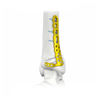 Proximale laterale Tibiale Verriegelungsplatte-II II