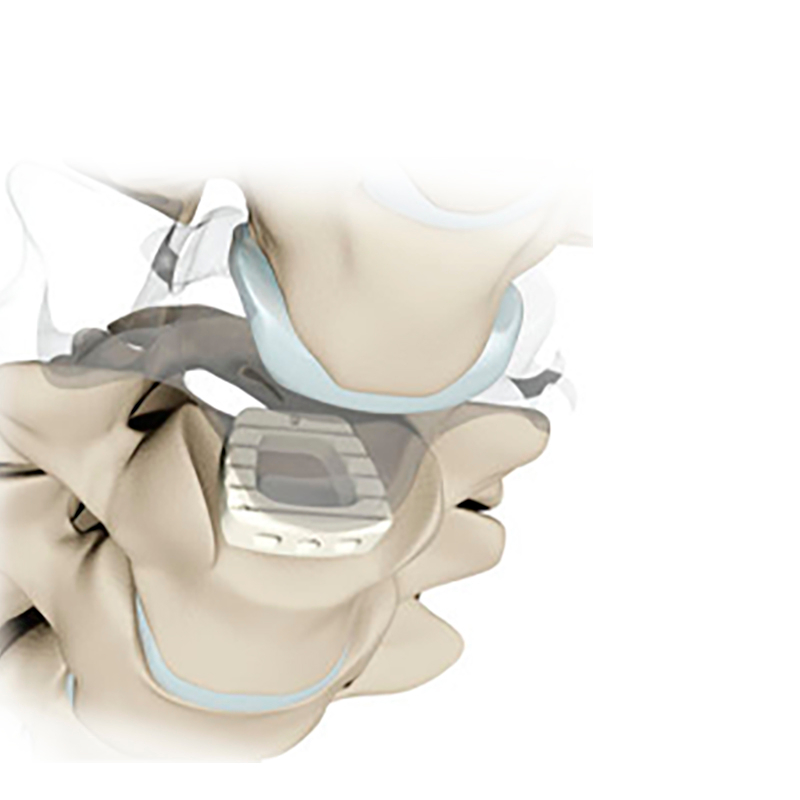 PEEK Cervical Peek Cage CZMEDITECH